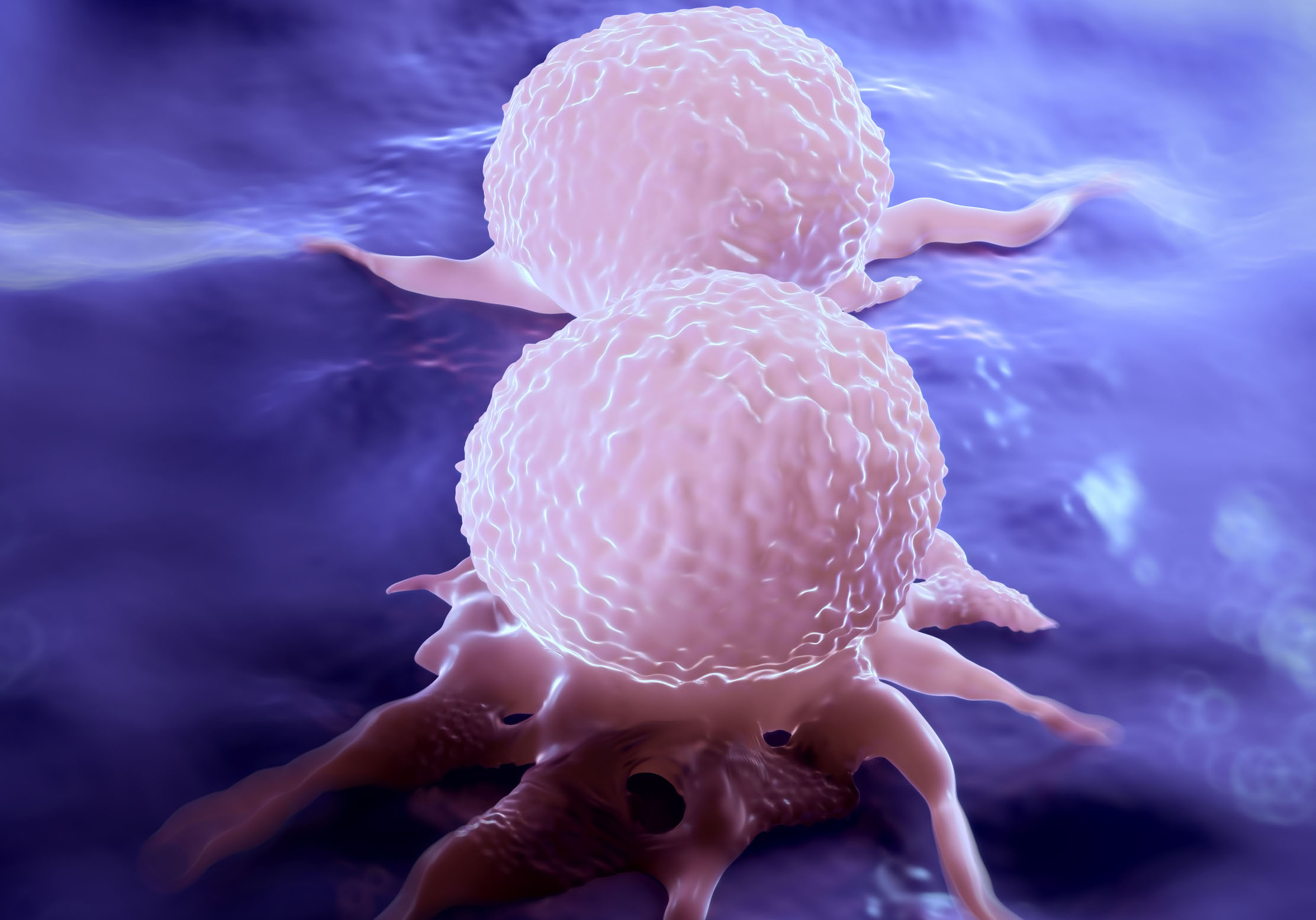 New Therapy Targets Breast Cancer Metastases in Brain