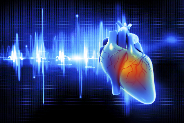 Assessing the Benefit of Heart Calcium Scans