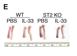 In normal mice (labeled WT), the IL-33 treatment drastically altered the bone marrow, causing lighter colored bone marrow compared to the control treated mice (labeled PBS). This indicates a significant expansion of immune cells as opposed to red blood cells. The ST2 KO mice, which are incapable of responding to IL-33, showed no changes.