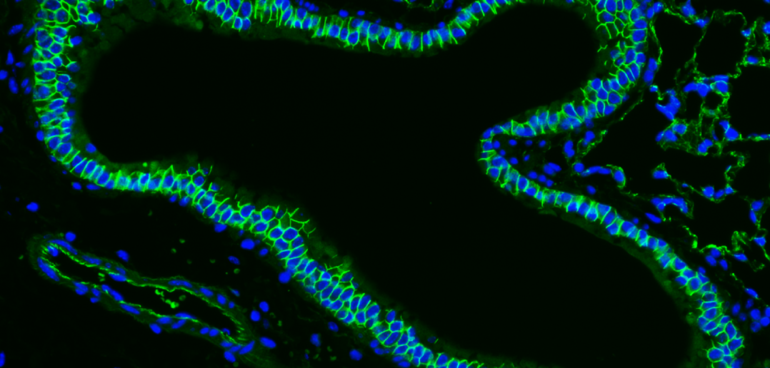 Lung airway and vein catenin stain