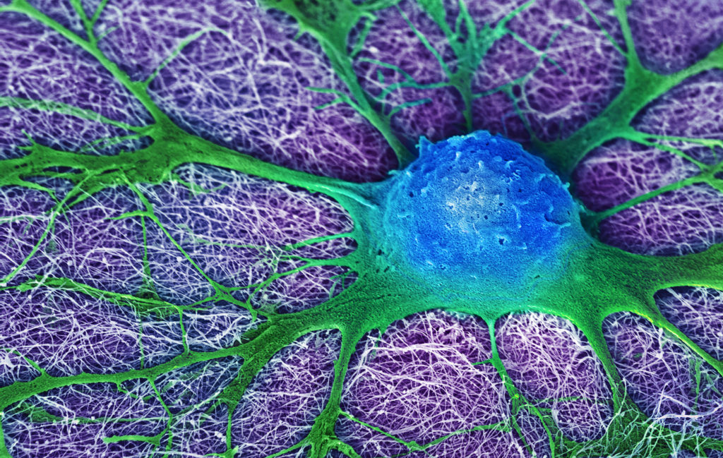 image-17-neural-cell-looking-for-friends-by-mark-mcclendon-5th-2016crop