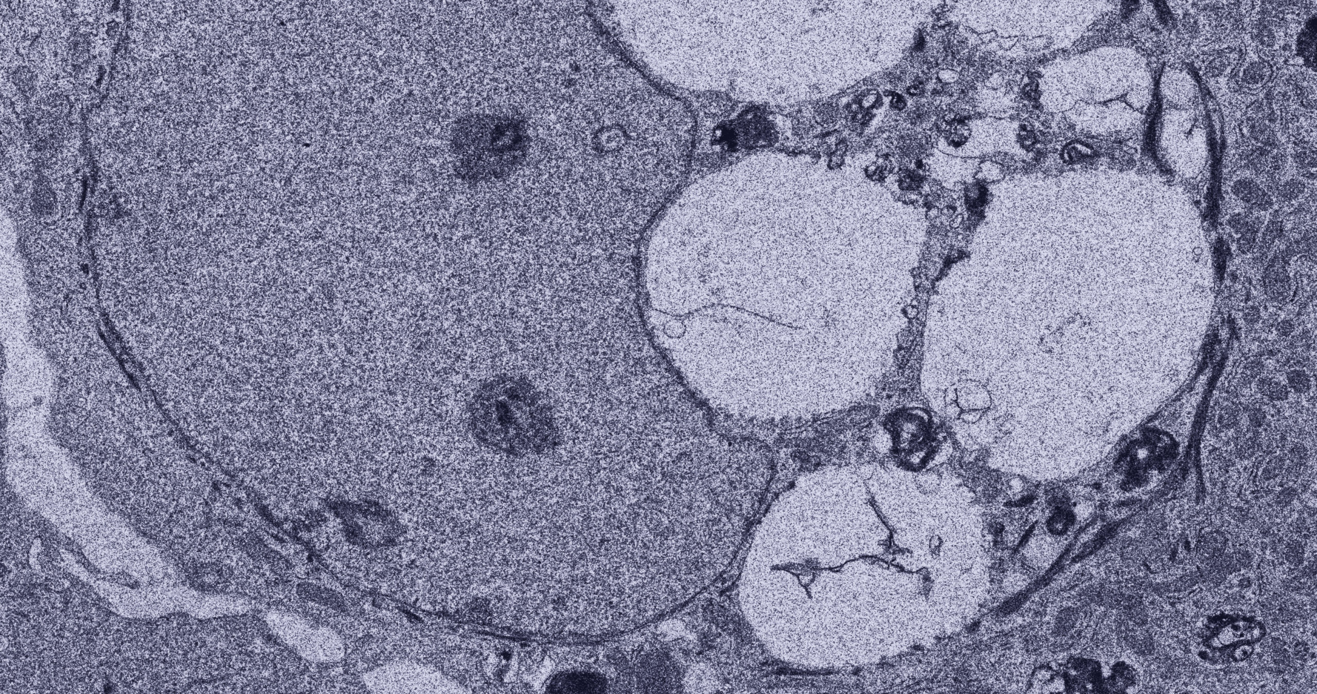 Investigating the Role of MicroRNAs in Regulating Stem Cells of the Eye