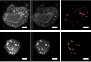 Northwestern and Purdue scientists discovered increased levels of unsaturated fatty acids in ovarian cancer stem cells. 