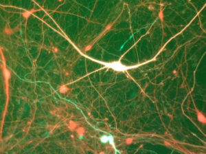 neurons-thompsongeorge