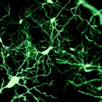 Uncovering the Causes of Neuron Dysfunction in Huntington’s Disease 
