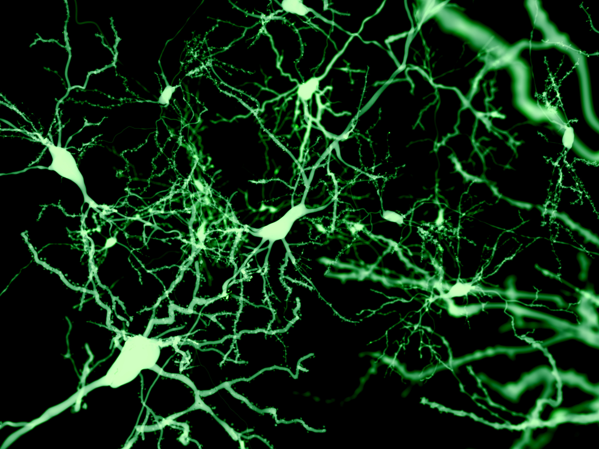 Uncovering the Causes of Neuron Dysfunction in Huntington’s Disease 