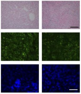 Hossein Ardehali, MD, PhD, professor of Medicine in the Division of Cardiology and of Pharmacology, studied human liver samples and found iron overload is associated with lower levels of the SIRT2 protein.