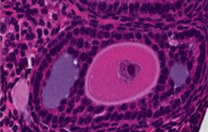This photo of antral follicles is a way to measure ovarian reserve. 