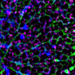 Using cryo-electron tomography and super resolution light microscopy, scientists were able to see, for the first time more detailed structures of nuclear lamins. This high magnification super-resolution image of a region of the nuclear surface shows a meshwork of lamin fibers (green) and chromatin (DNA) seen in blue and magenta.