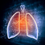 Study Discovers Novel Therapeutic Target for Acute Respiratory Distress Syndrome