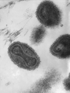 This transmission electron microscopic image depicts smallpox virus virions. The hourglass-shaped structure inside the smallpox virion is the viral core, which contains the viral DNA that as the blueprint by which the virus replicates itself once it is released into the host cell. Photo credit: CDC/ Dr. Fred Murphy; Sylvia Whitfield