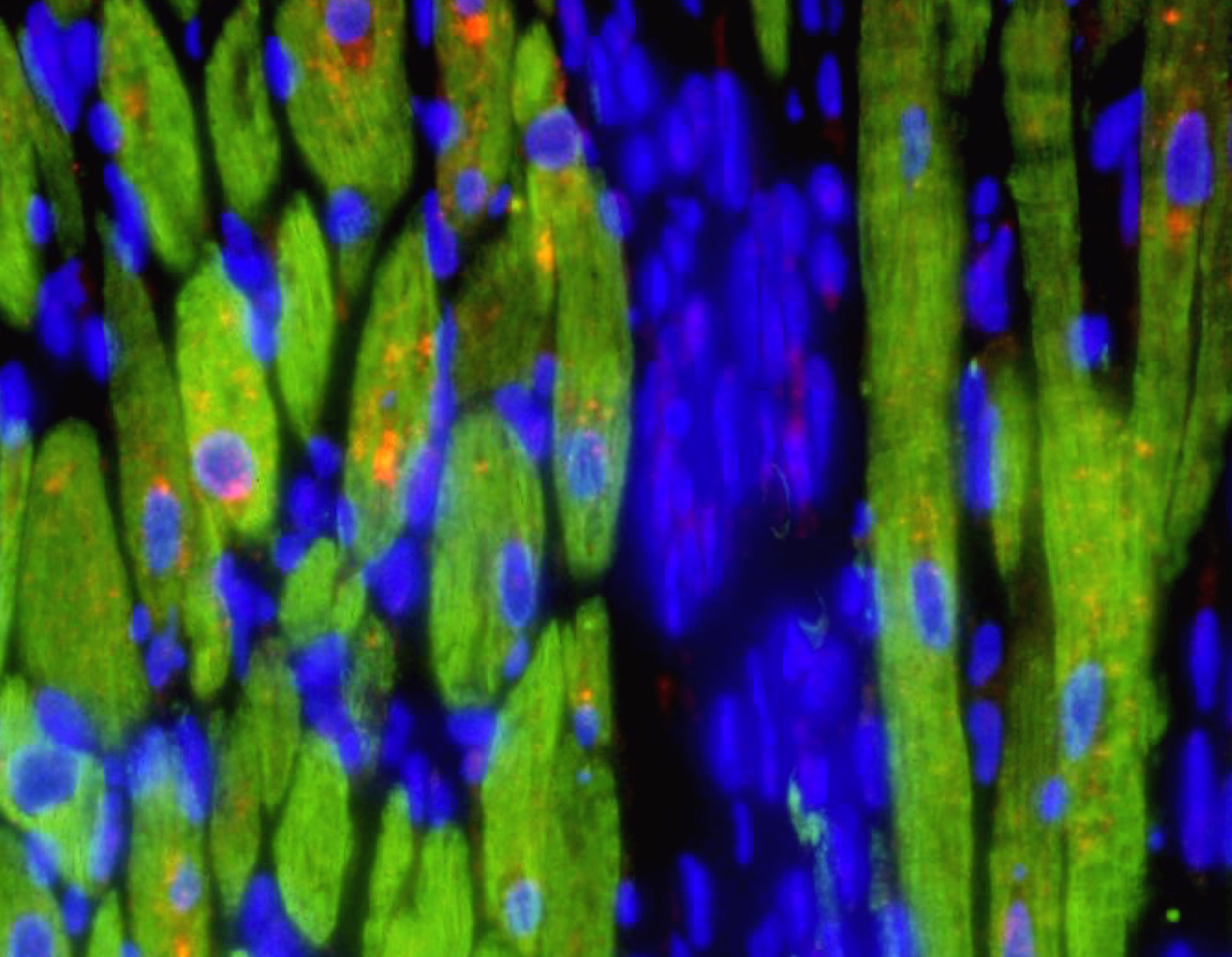 Root of Cardiac Fibrosis Defined