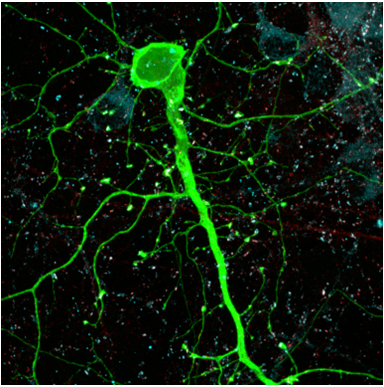 Active Non-Coding DNA May Help Pinpoint Genetic Risk for Psychiatric Disorders