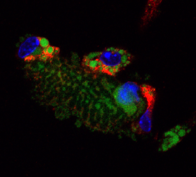 Red immune cells “feasting” on a large dying green cardiac cell.