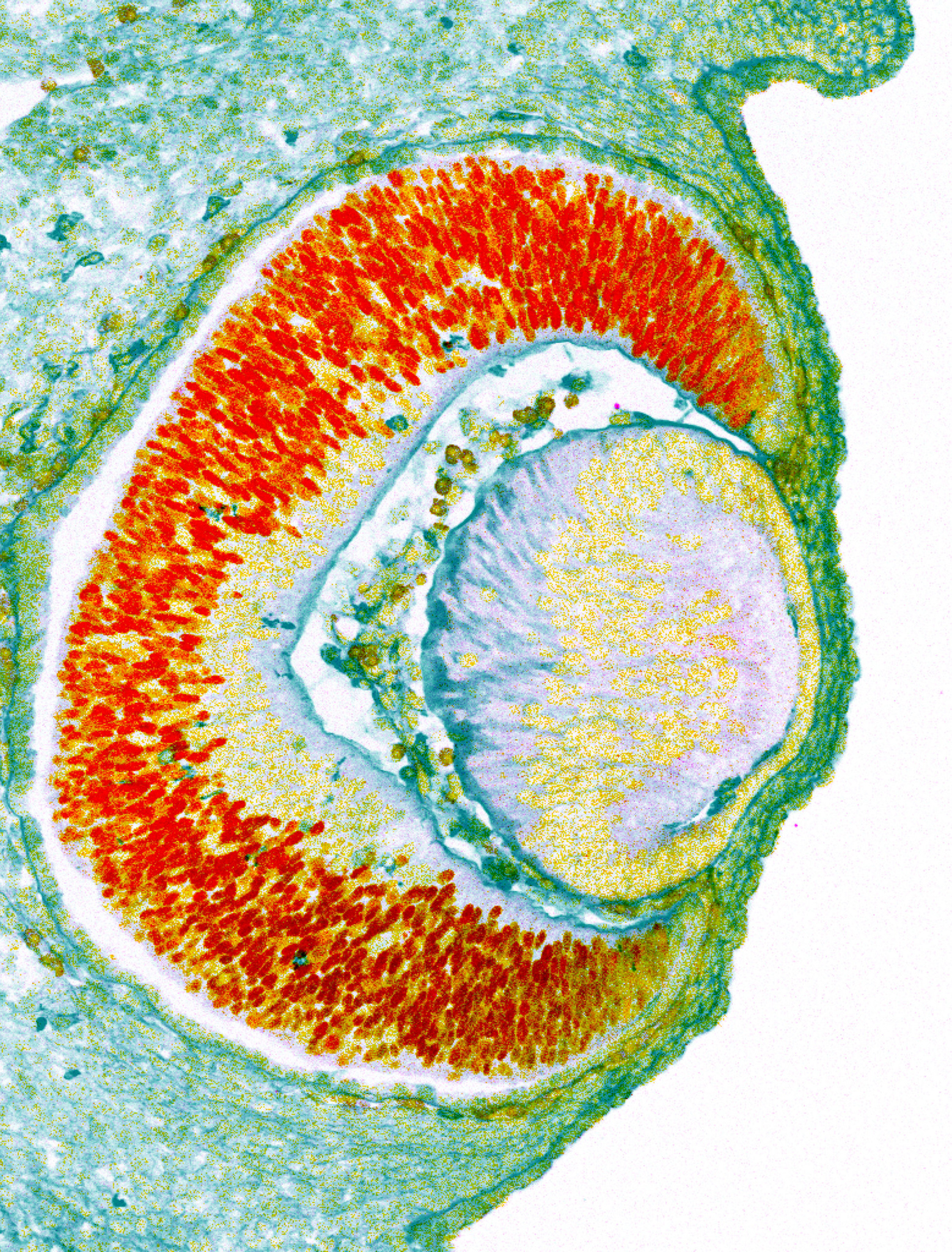 Exploring the Genetics of Glaucoma and Retinal Development