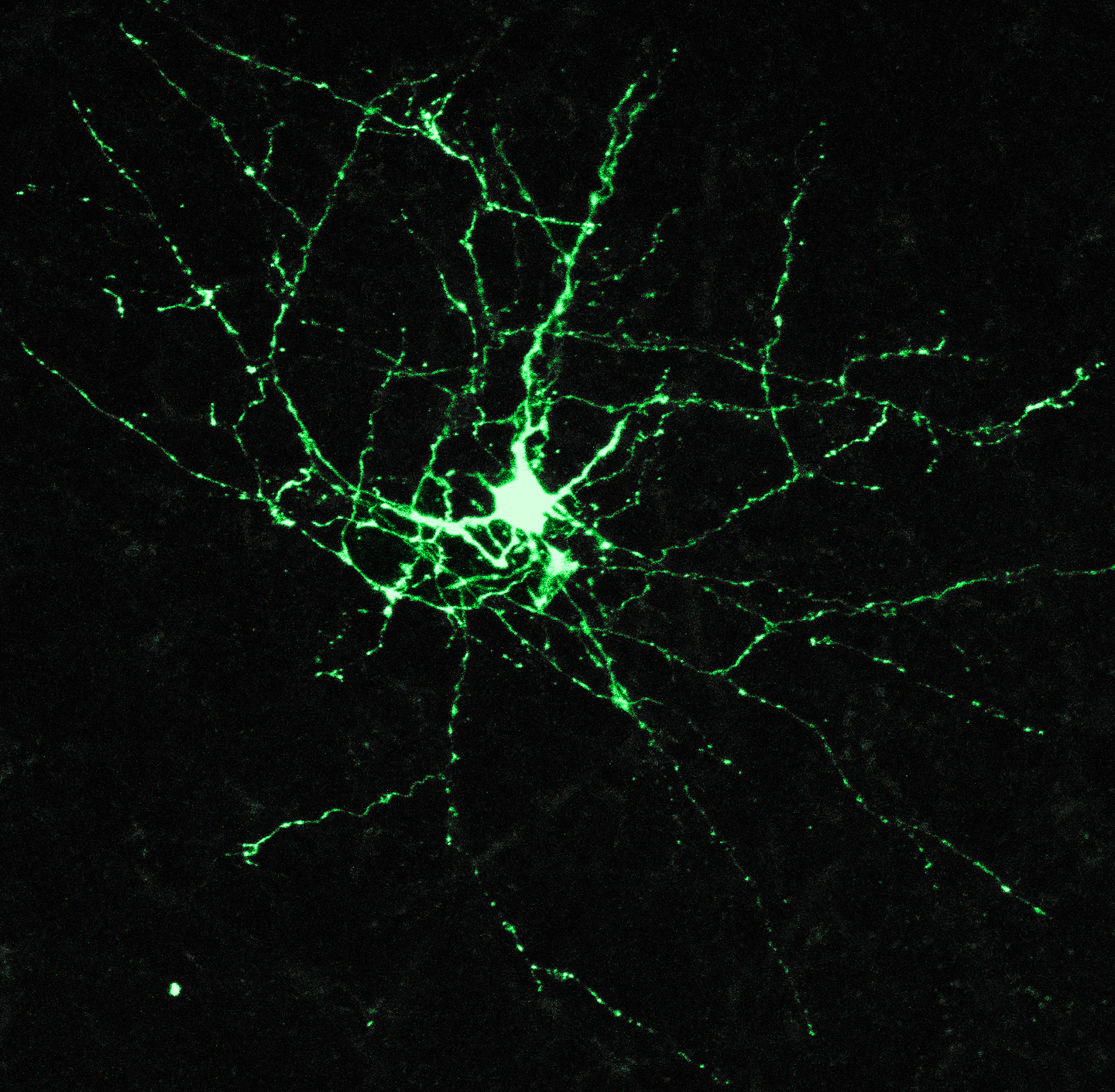 Delayed Development of Fast-Spiking Neurons Linked to Fragile X