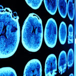 Fluorescent Label Passes Through Blood-Brain Barrier