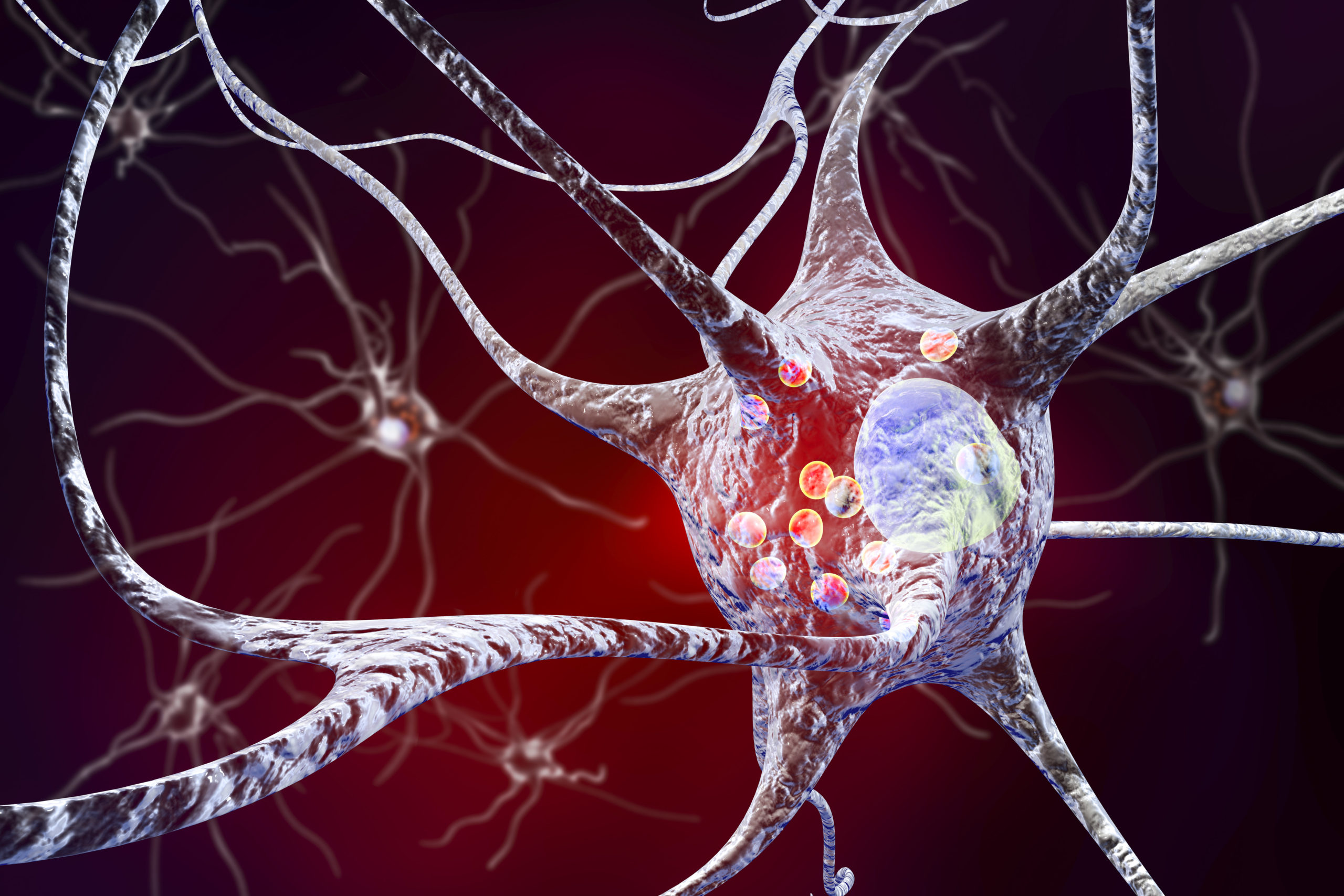 New Findings Point to Potential Therapy for Parkinson’s Disease