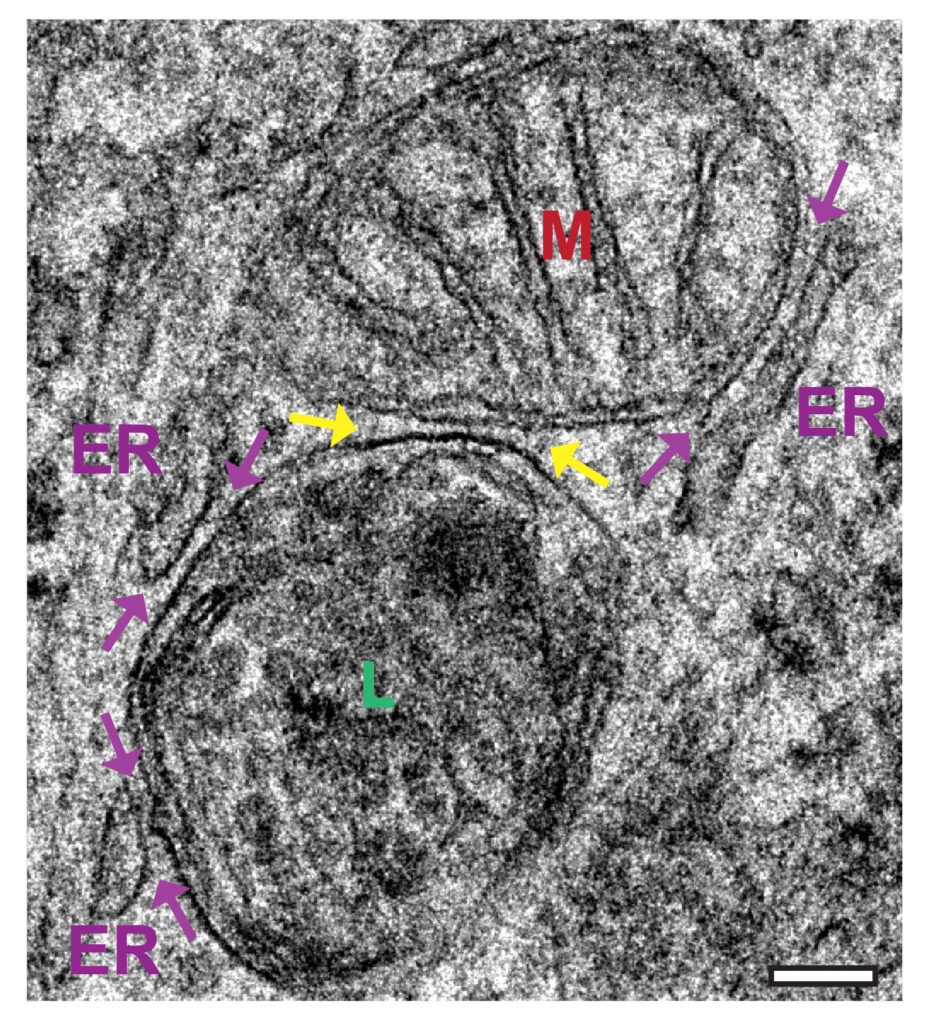 wong-krainc-mitochondria-lysosome-contact-01