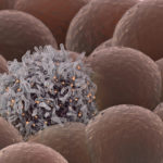 Investigating How Tumor-Immune Cell Clusters Drive Cancer Spread 