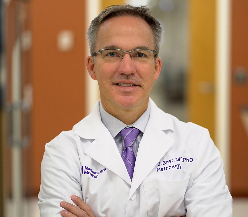 Daniel Brat, MD, PhD, chair of Pathology, was the lead neuropathologist on the study, which demonstrated software that can forecast the survival of patients diagnosed with brain cancer.