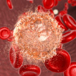 Study Identifies Novel Therapeutic Target for Acute Myeloid Leukemia