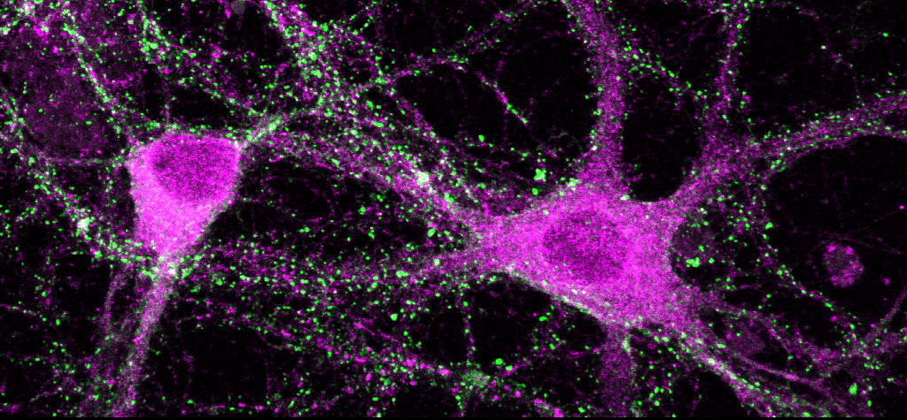 Decoding Hidden Brain Conversations to Advance Neuroprostheses