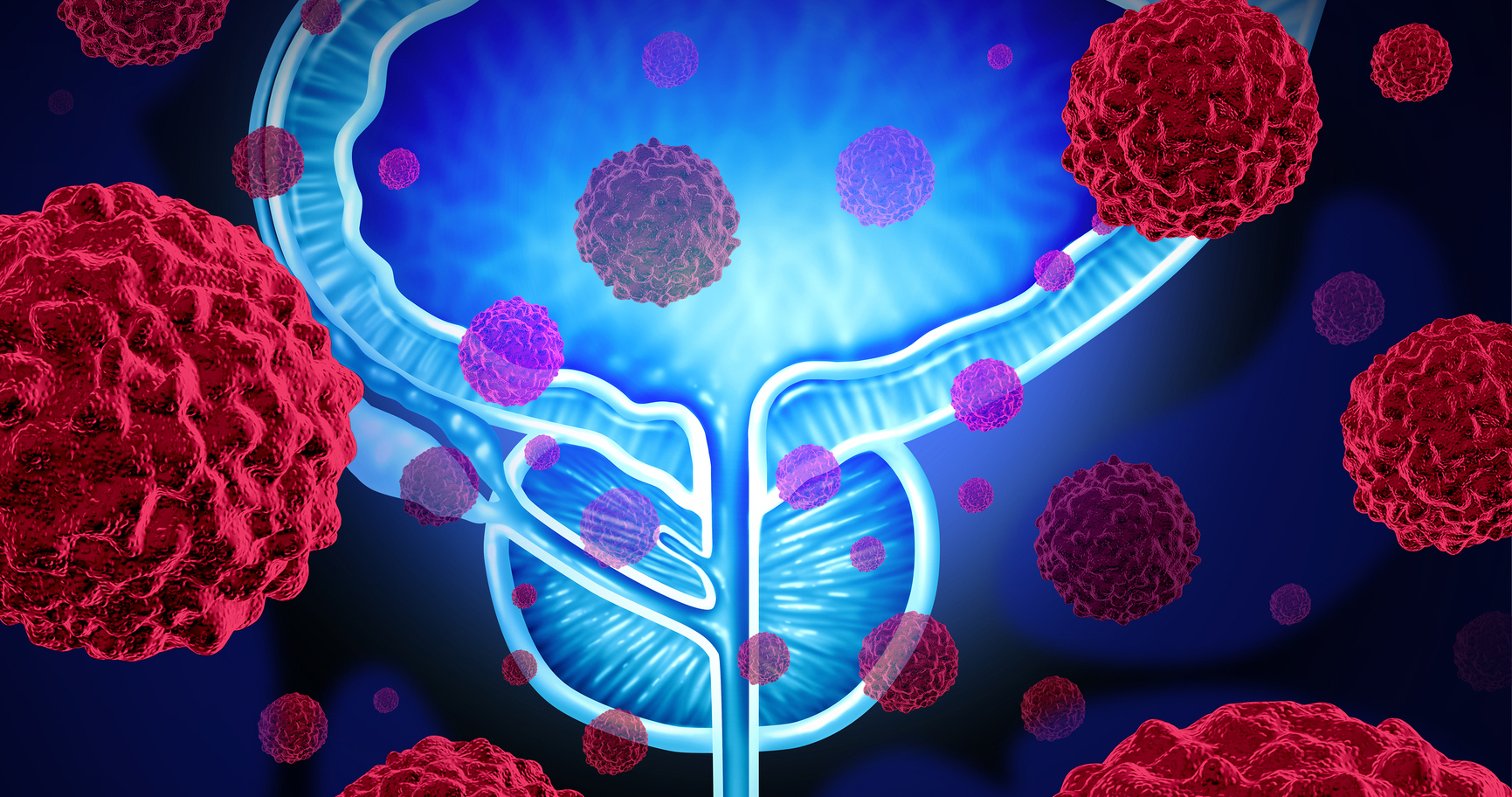 Evaluating Drug Regimens for High-Risk Prostate Cancer