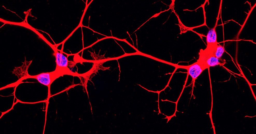 als_neurons