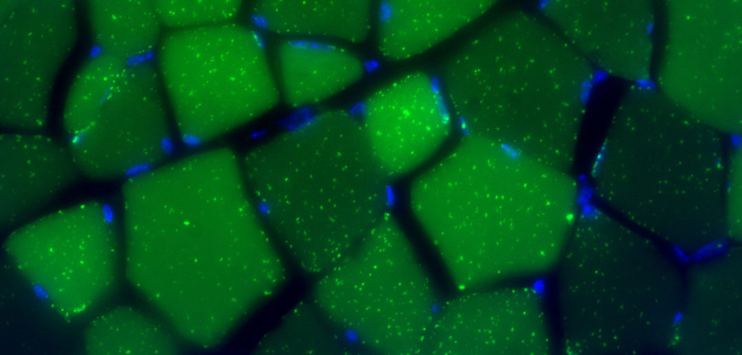 Fasting for 24 hours induced dramatic formation of autophagic vesicles (green dots, labeled by a marker protein LC3 tagged with the green fluorescent protein) in skeletal muscle. Blue indicates DAPI-stained nuclei.