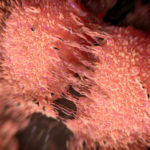 New Regulator of Prostate Cancer Metastasis Discovered