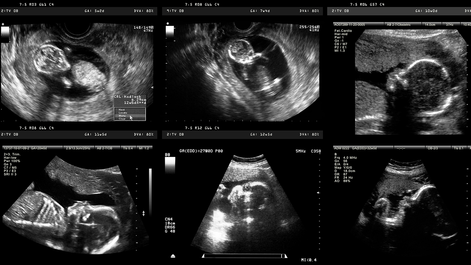 Refining Standards of Maternal-Fetal Care