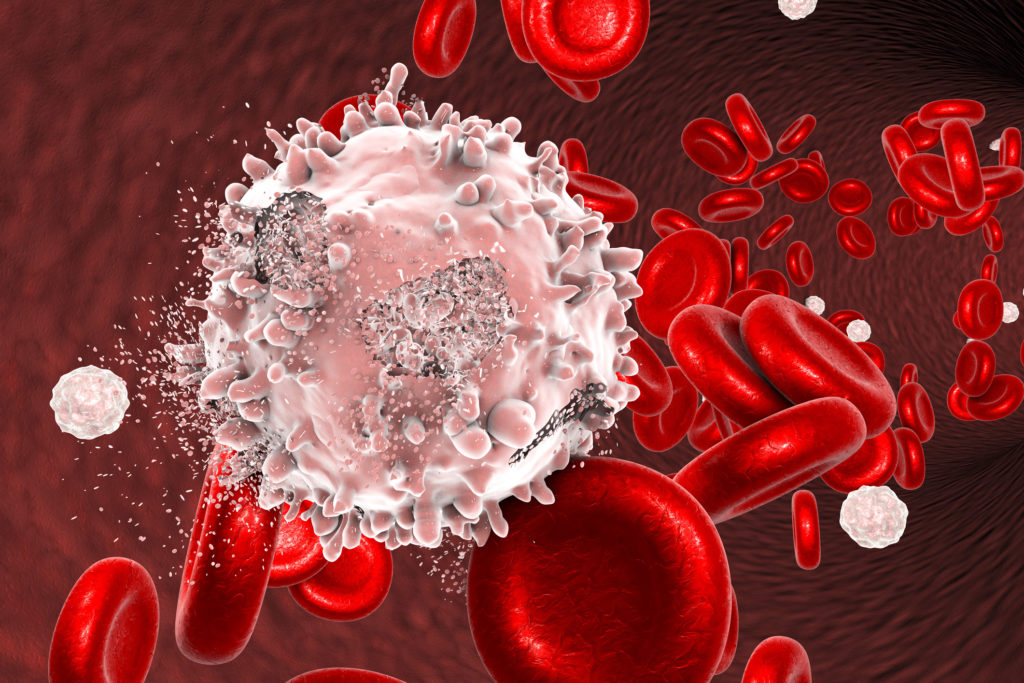 How Inflammation Fuels Blood Cancer Risk - News Center