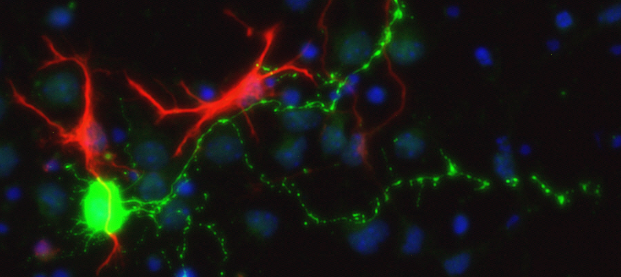 Proteins on Neuron Surfaces Prove Pivotal for Communication