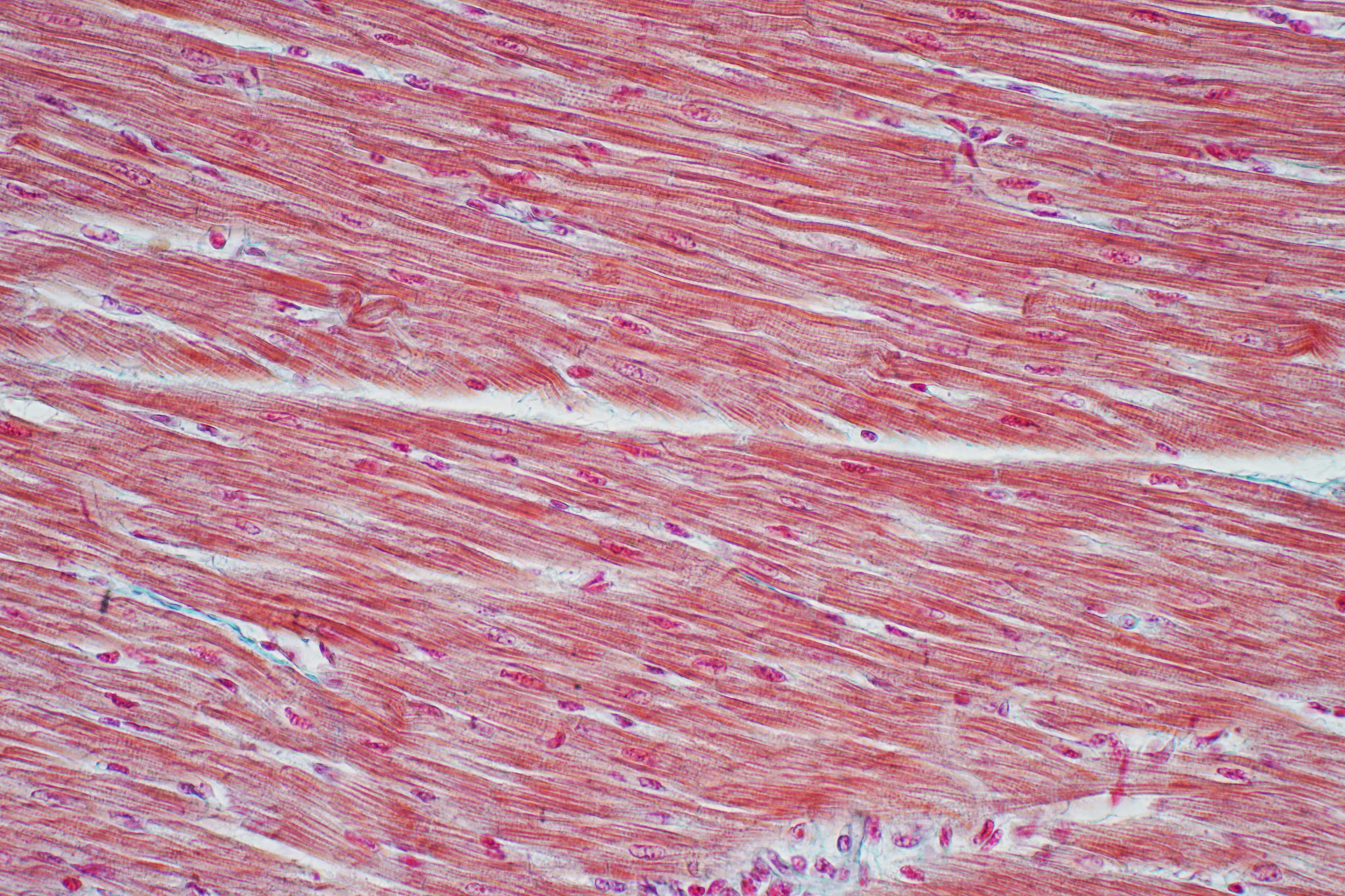 Mechanisms Driving Inherited Heart Disease