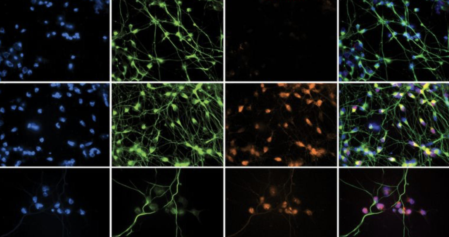 Human Stem Cell Model Reveals Mechanisms of Herpes Infection