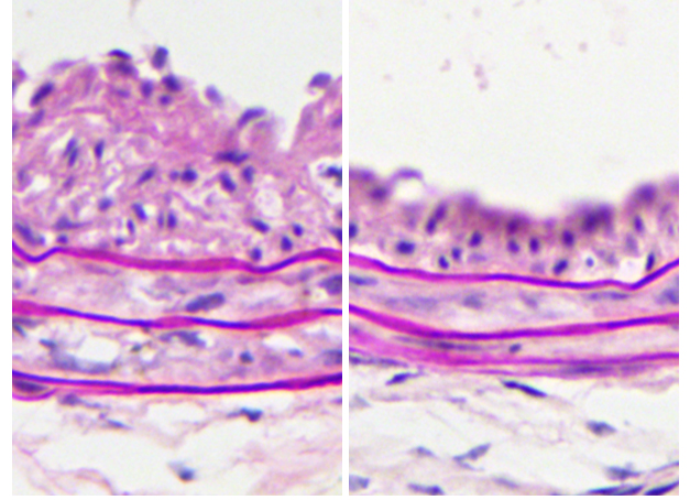 Student Investigates Role of Microbiome in Arterial Injury Response