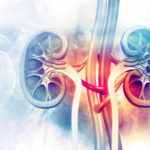 Identifying Patients at Lower Risk for Kidney Transplant Rejection