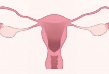 Radiation plus chemotherapy doesn’t improve endometrial cancer recurrence-free survival