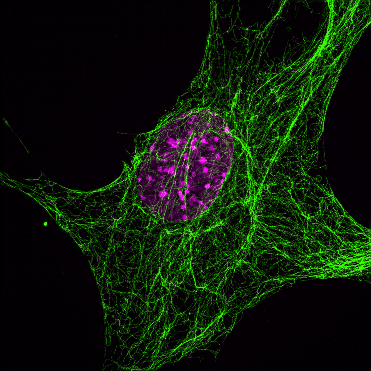 Protein Protects Nucleus from Rupture