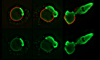 Unraveling the Cellular Mechanisms Behind Inflammation