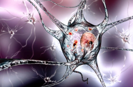 Specialized Immune Cells May Improve Early Detection of Parkinson’s Disease