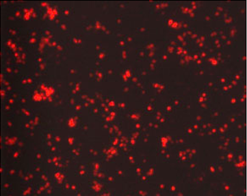 Novel Method Maps Virus-Host Protein Interactions