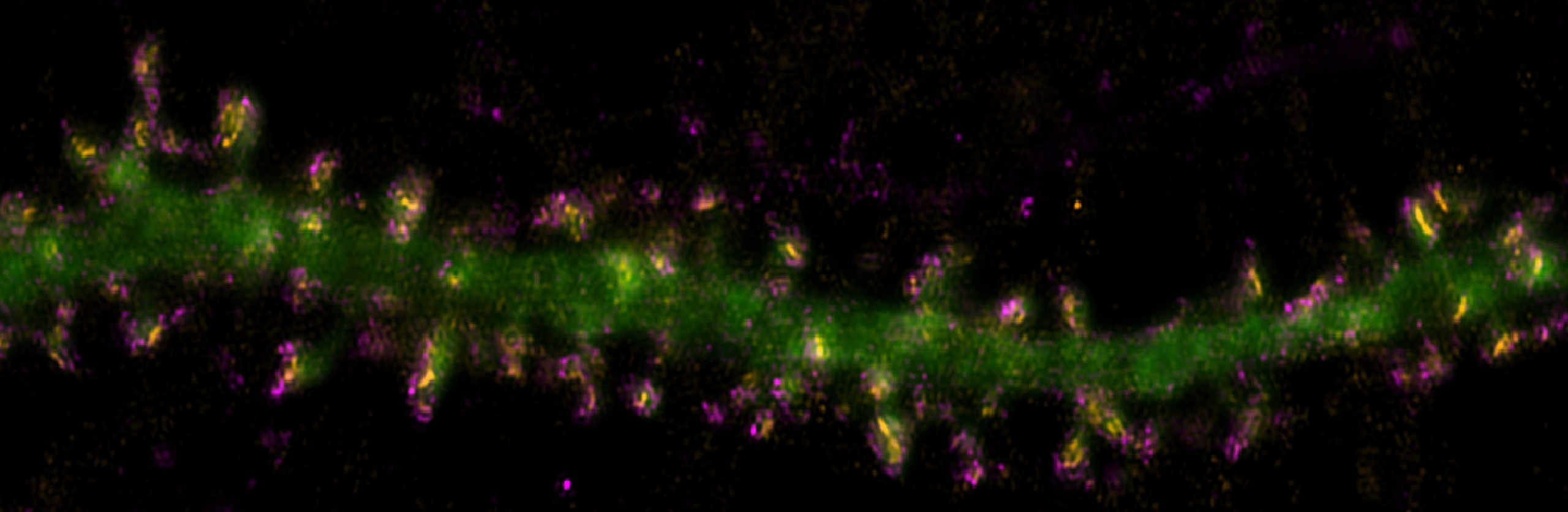 Uncovering the Impact of Protein Mutations in Parkinson’s