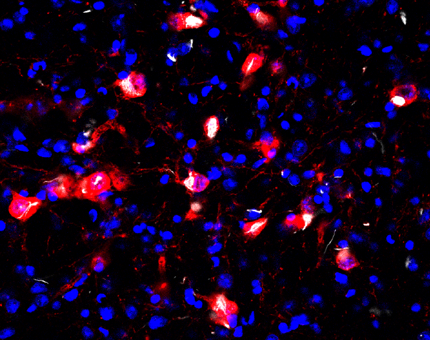 New Developments in Parkinson’s Pathology