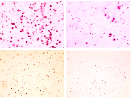 Inhibiting SAM Biosynthesis to Slow Tumor Growth