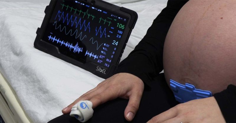 Northwestern Team Develops Wireless Monitors for Pregnant Moms