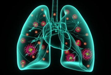 Why COVID-19 pneumonia lasts longer, causes more damage than typical pneumonia