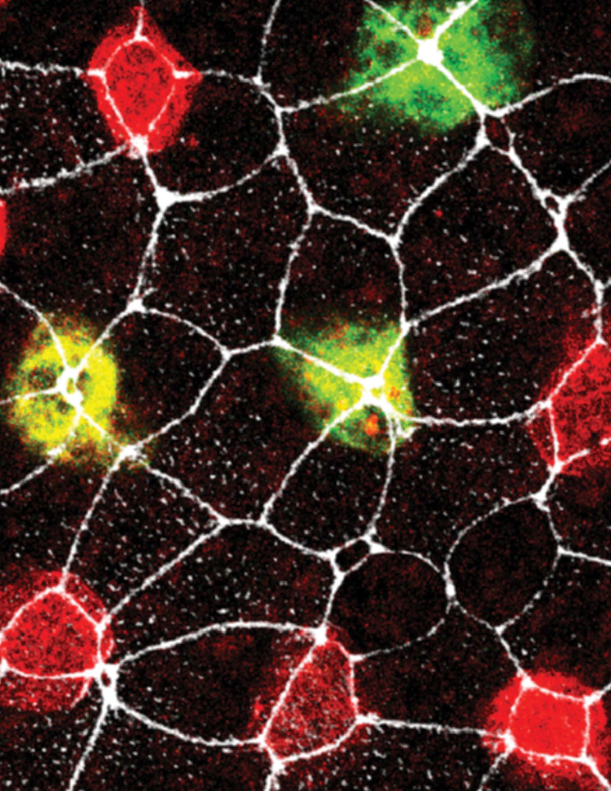 Strengthened Microtubules Aid Cell Migration