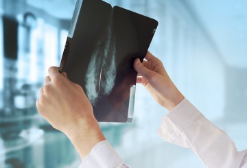 Can AI reduce time to breast cancer diagnosis?